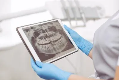 3D digital x-rays available at Prosthodontic Associates of New Jersey