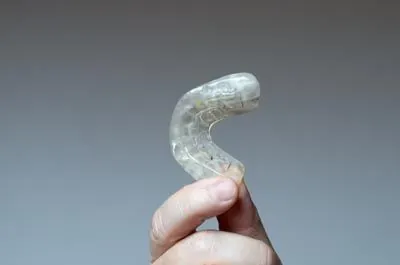 mouthguard used to help treat sleep apnea